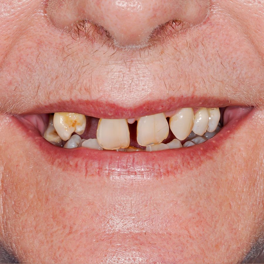 smile in a day - before - smile 26